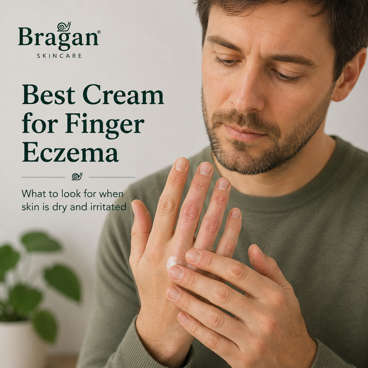 Man applying moisturising cream to dry, red and irritated fingers affected by finger eczema.