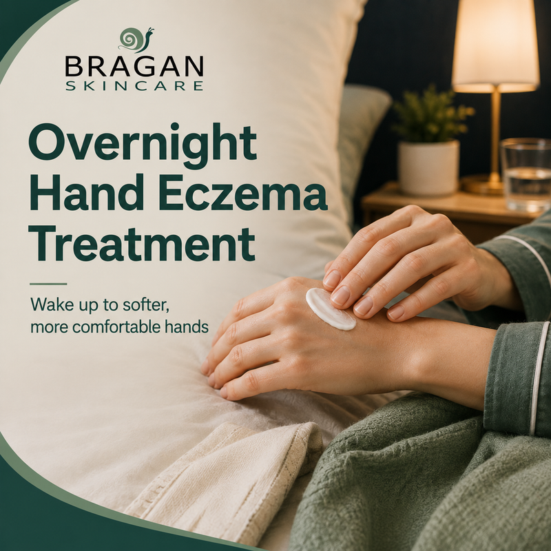 Overnight hand eczema treatment: Tips for softer hands by morning