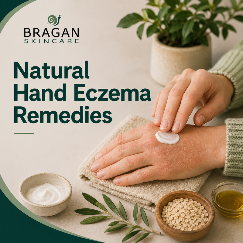 Natural hand eczema remedies: Gentle ways to support your skin