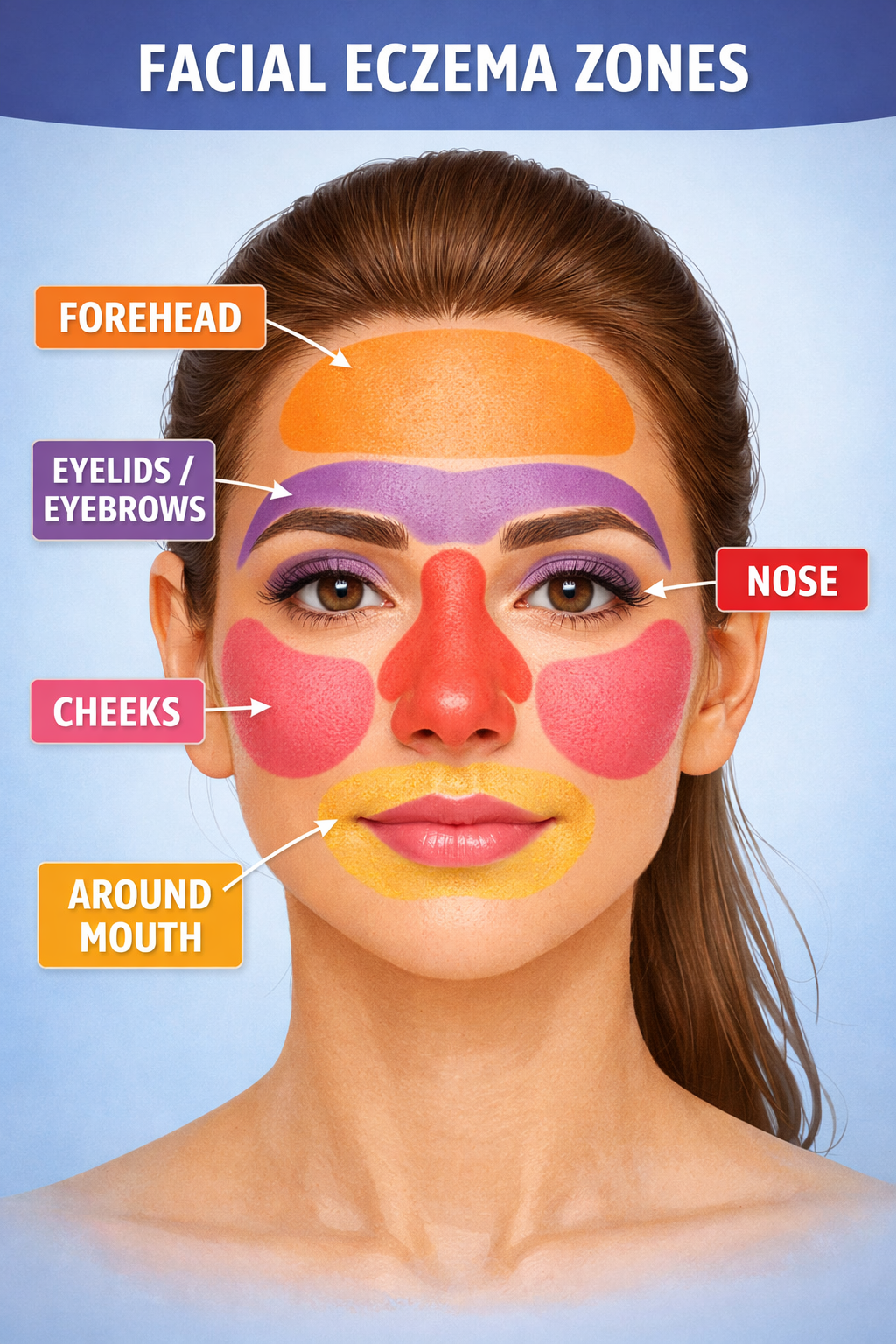 daigram of areas of the face affected by eczema