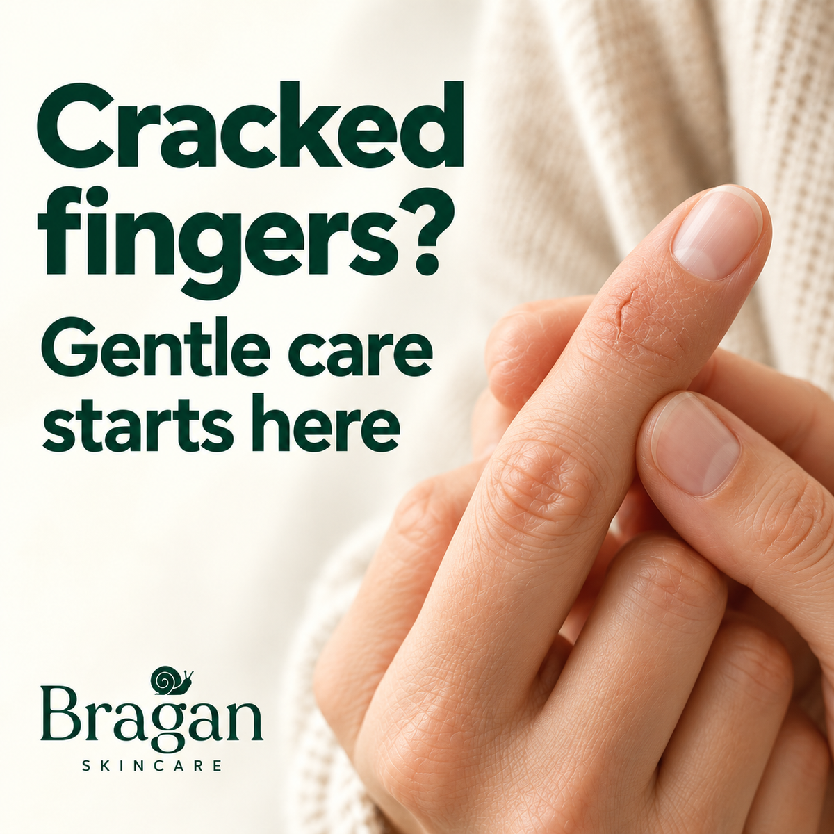 Person examining dry, cracked and irritated skin on a fingertip affected by finger eczema.