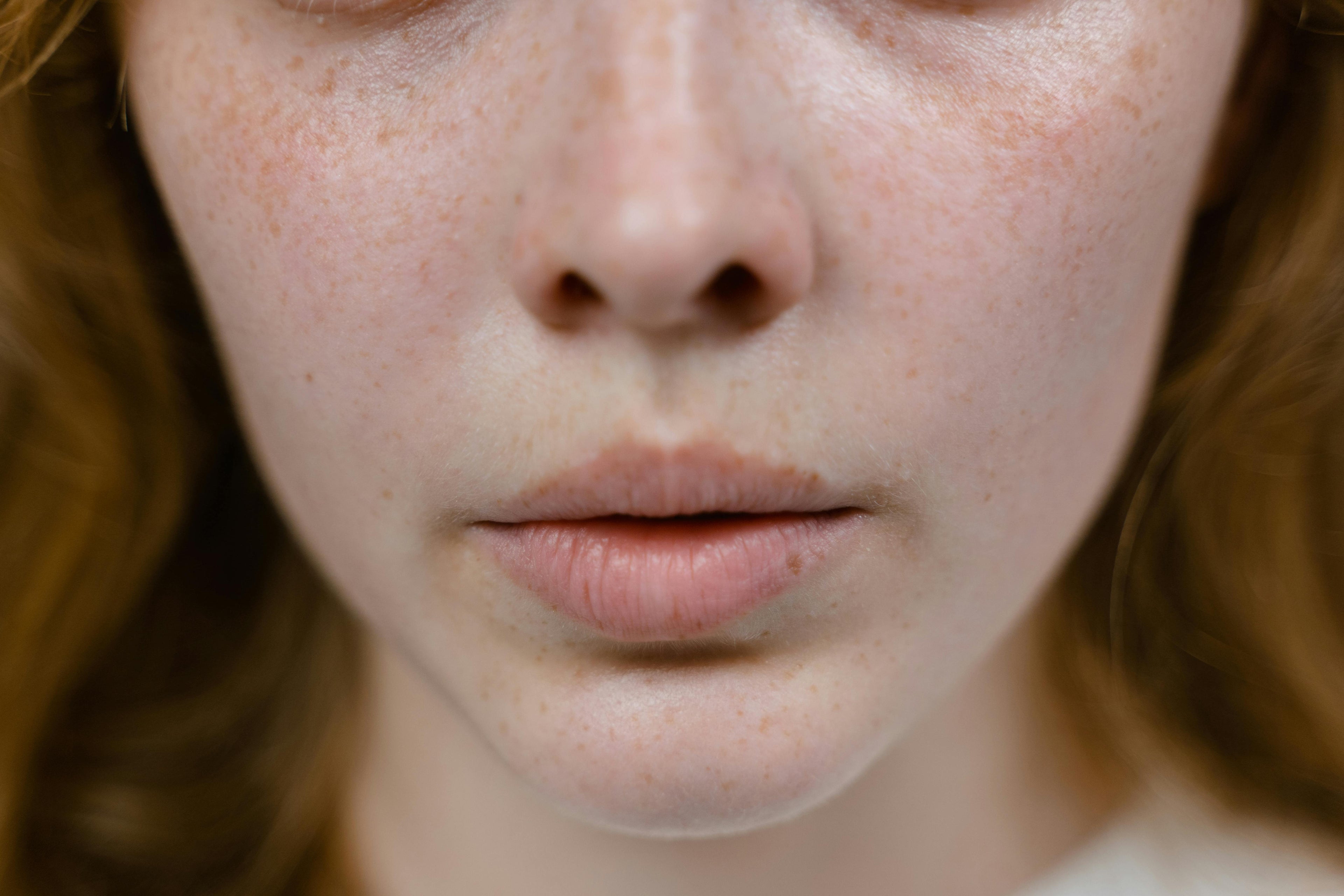 Damaged Skin Barrier