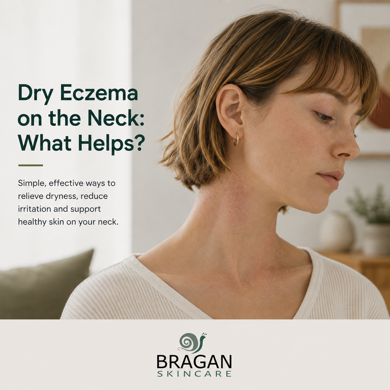 Woman with visible mild dryness and flaking on the side of her neck, illustrating dry neck eczema and gentle ways to soothe irritated skin.
