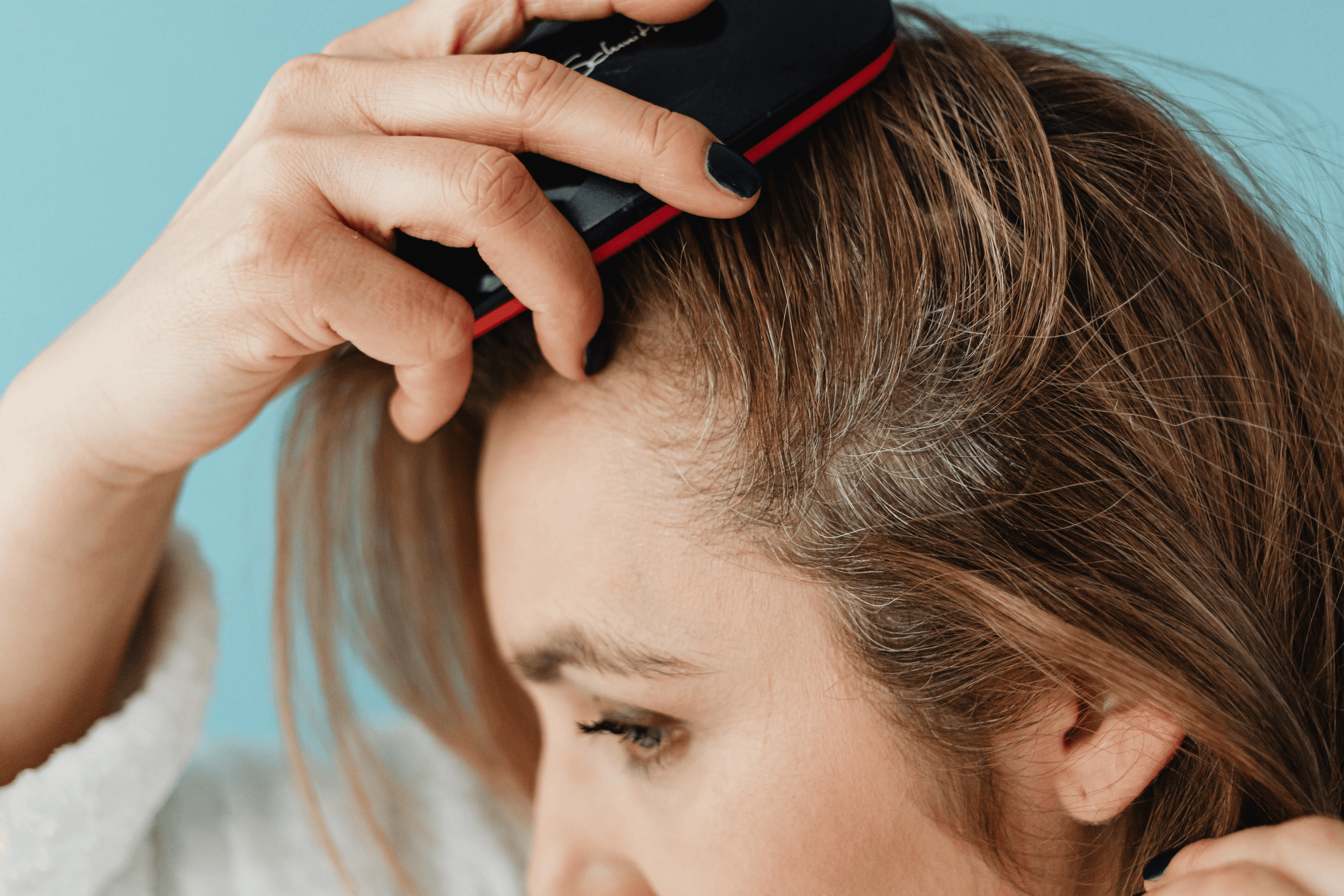 dry scalp photo