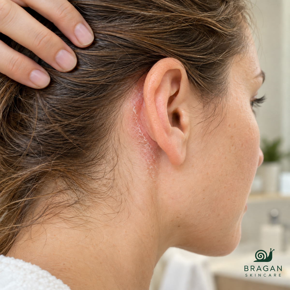 Close-up of dry, flaky skin behind a woman’s ear, with her hair held away.
