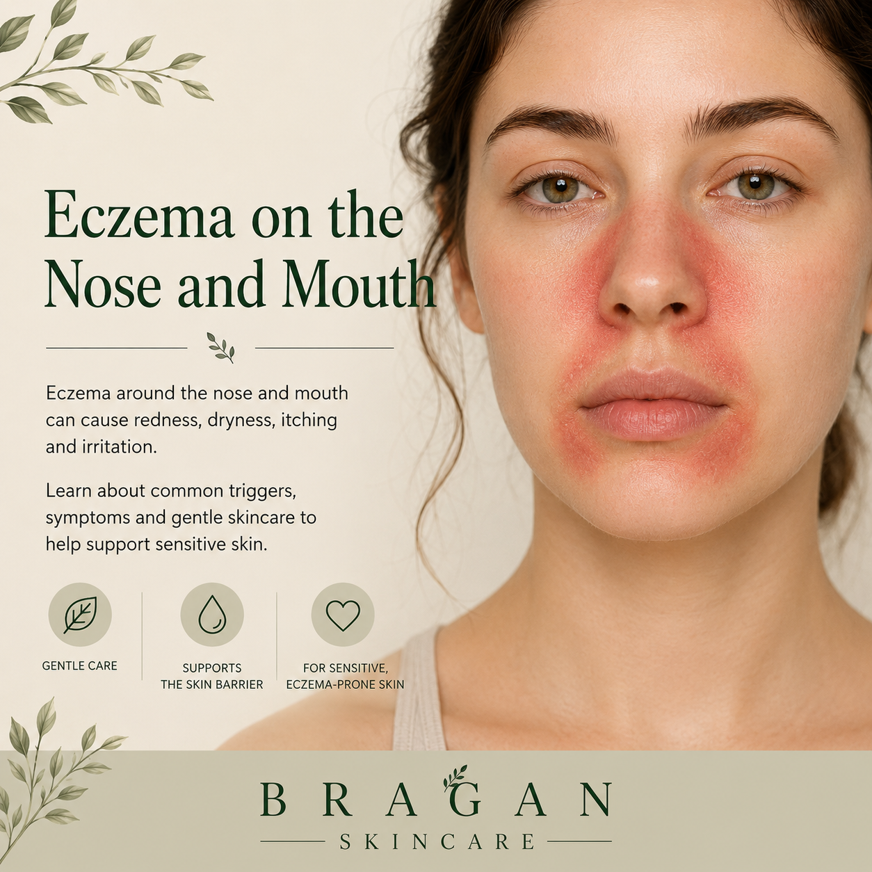 Illustration showing eczema around the nose and mouth, highlighting redness, dryness and irritation in these commonly affected facial areas, with everyday skincare guidance to help support the skin barrier