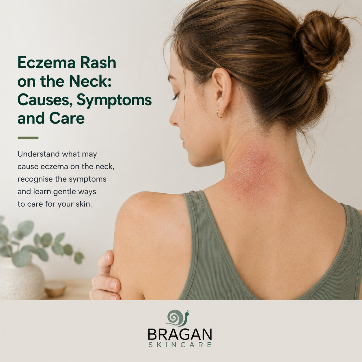 Woman showing a visible dry, red and flaky eczema rash on the back and side of her neck, illustrating neck eczema symptoms, causes and gentle skin care.