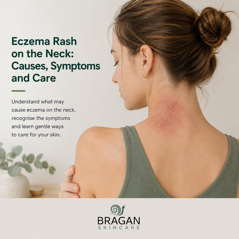 Eczema Rash on the Neck: Causes, Symptoms and Care