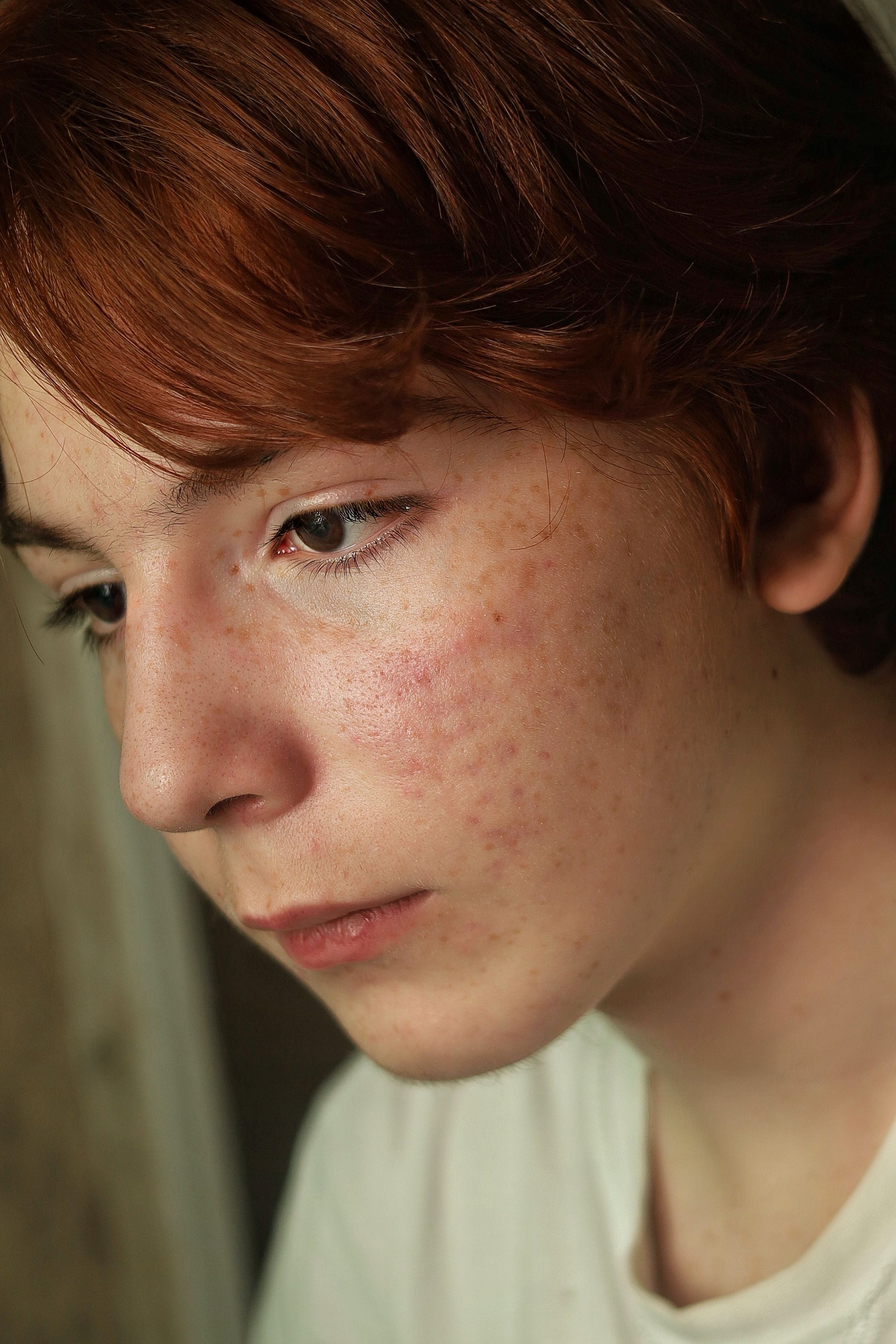 irirated facial skin