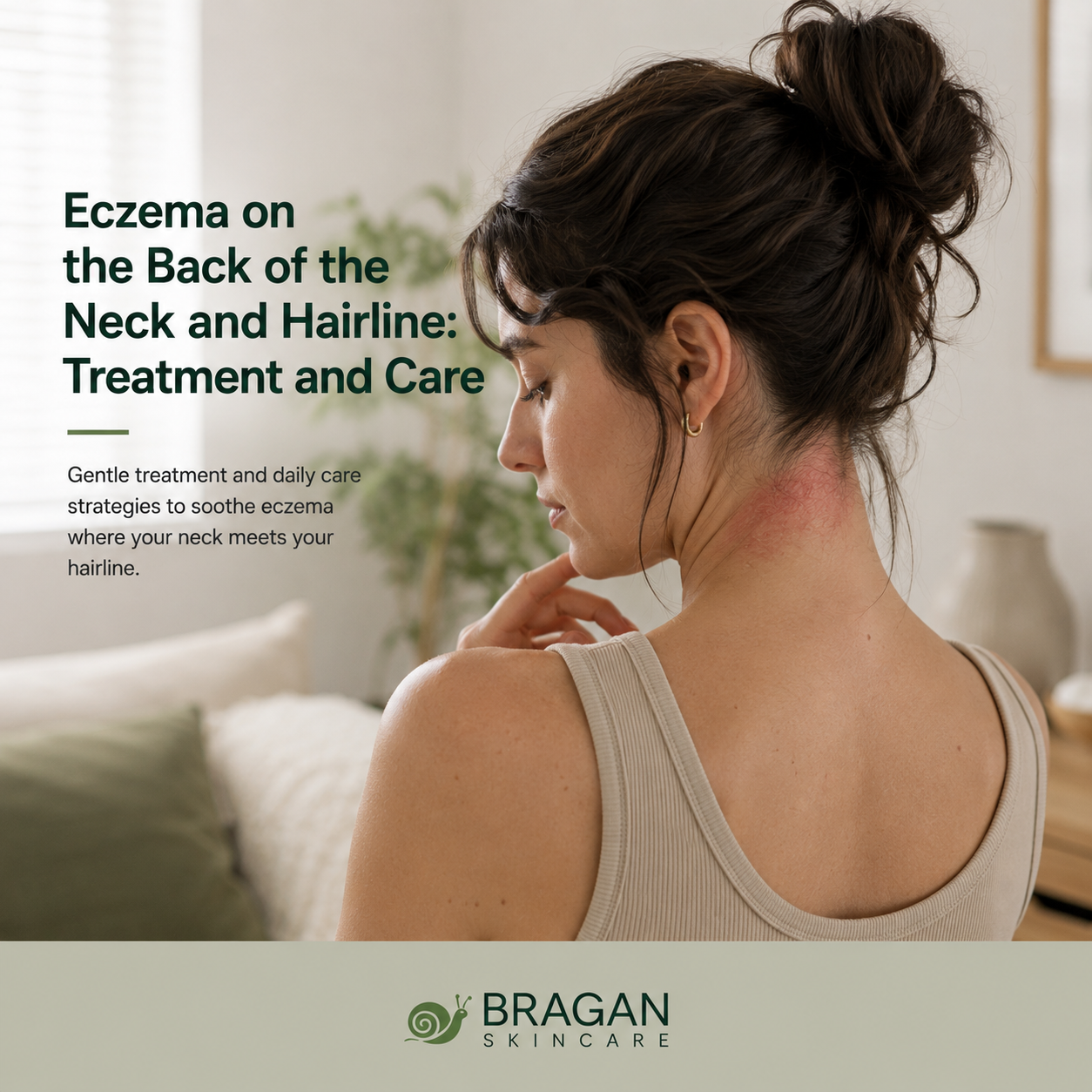 Woman showing visible eczema irritation at the back of the neck and along the hairline, illustrating treatment and gentle care for this sensitive area.
