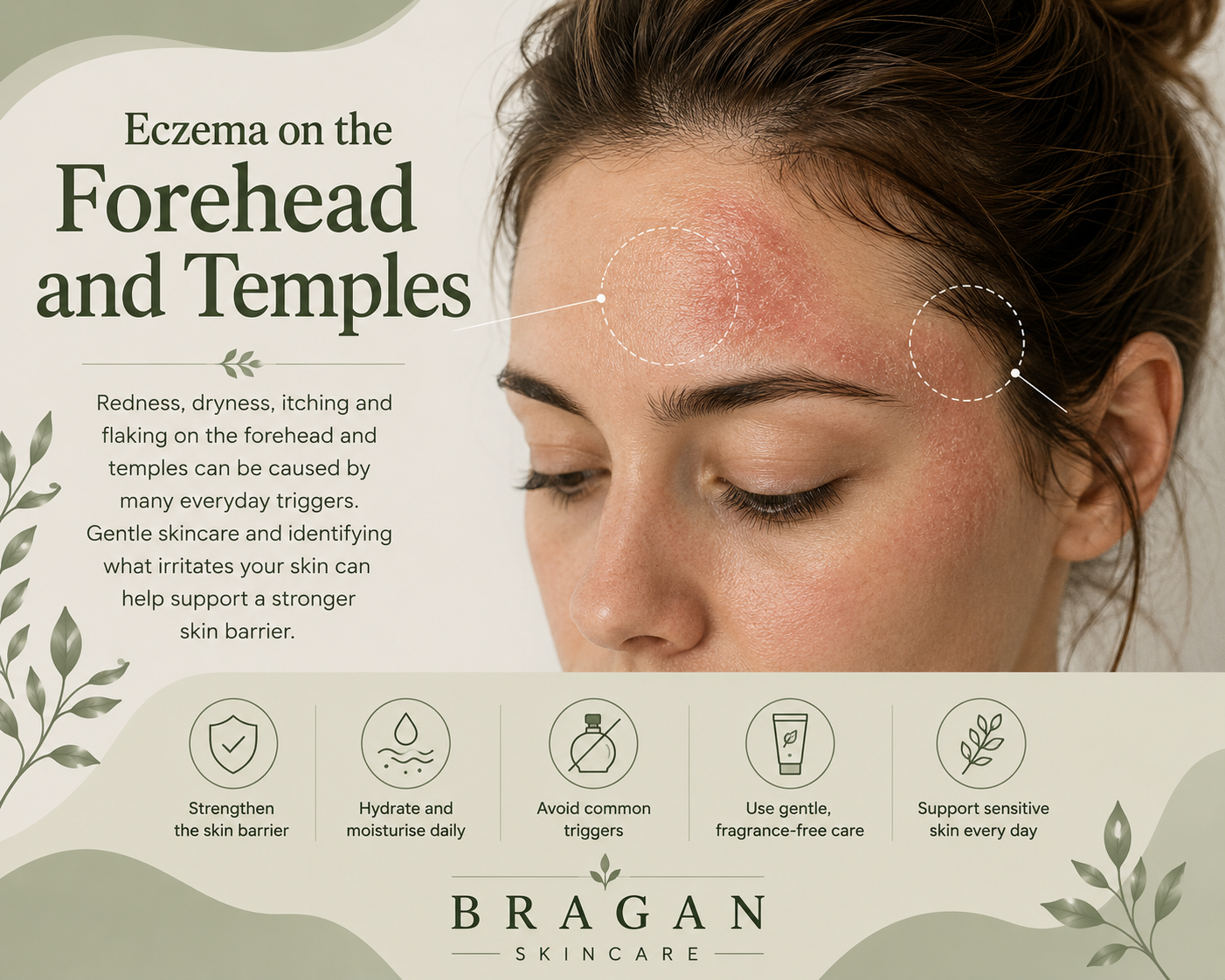 Illustration showing eczema affecting the forehead and temples, highlighting common symptoms, possible everyday triggers and gentle skincare tips to help support the skin barrier