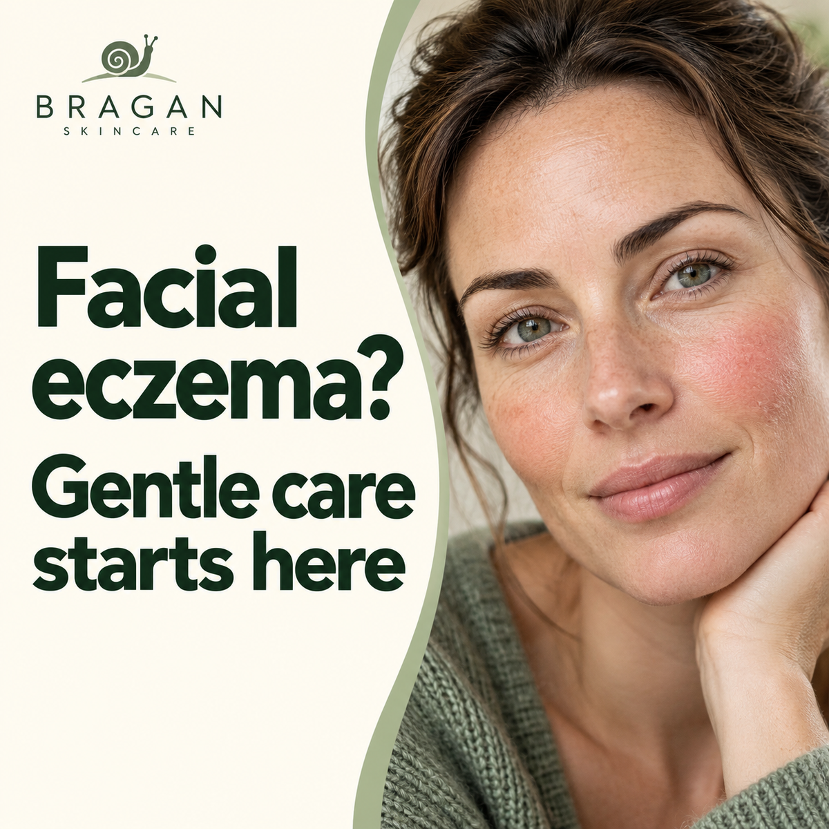 Woman touching a mild patch of facial eczema on her chin, with the text Facial eczema: Calm. Hydrate. Protect.