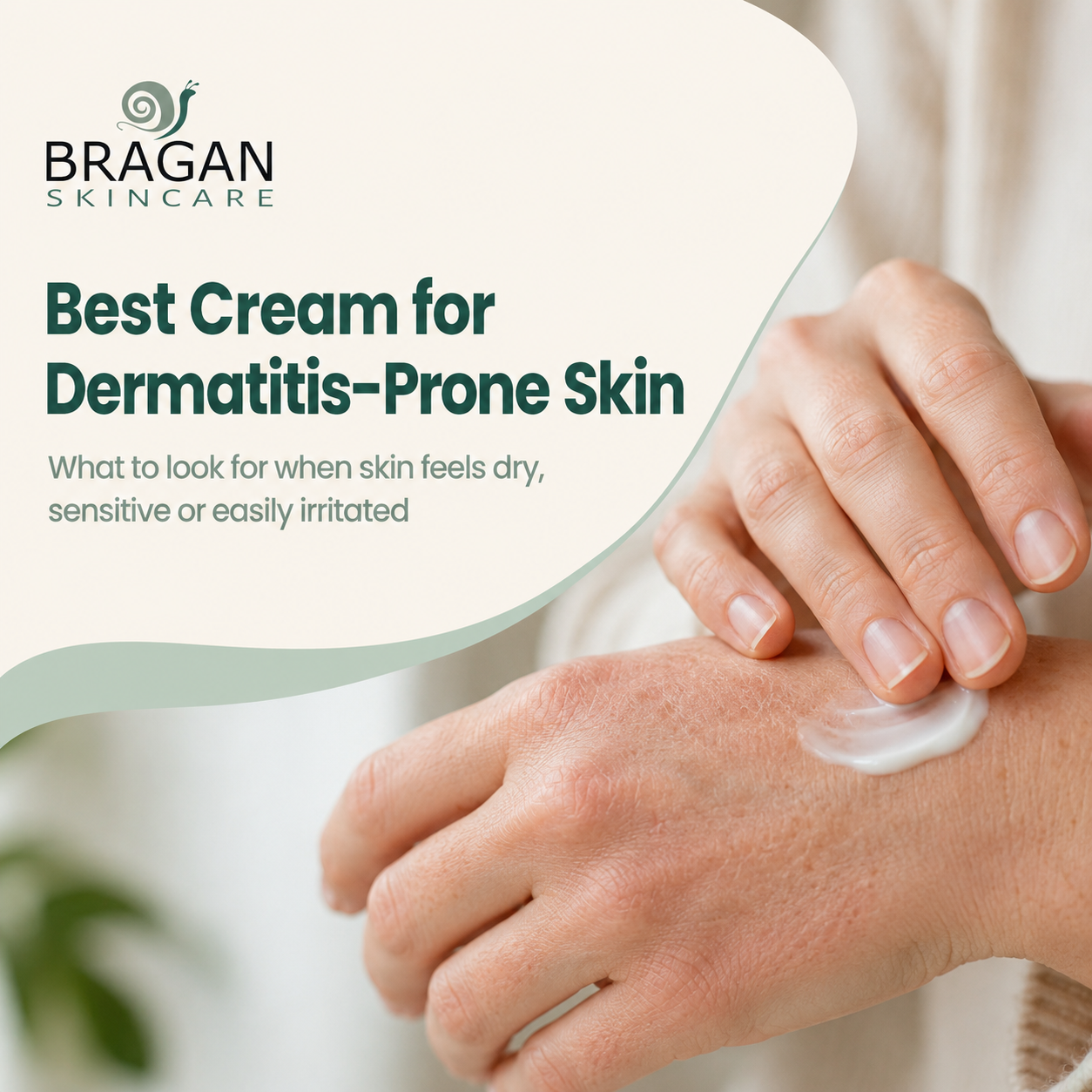 Person applying moisturising cream to dry, irritated hands beside the title Best Cream for Dermatitis-Prone Skin.