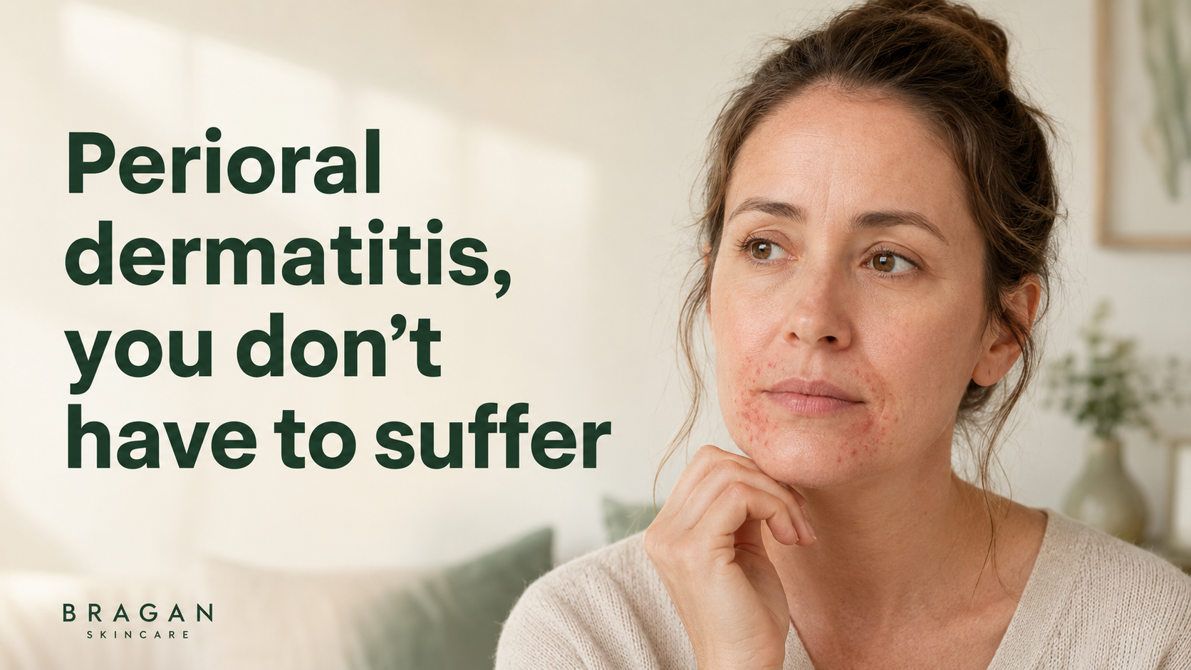 Woman with visible perioral dermatitis around her mouth and chin beside the message “Perioral dermatitis, you don’t have to suffer.”