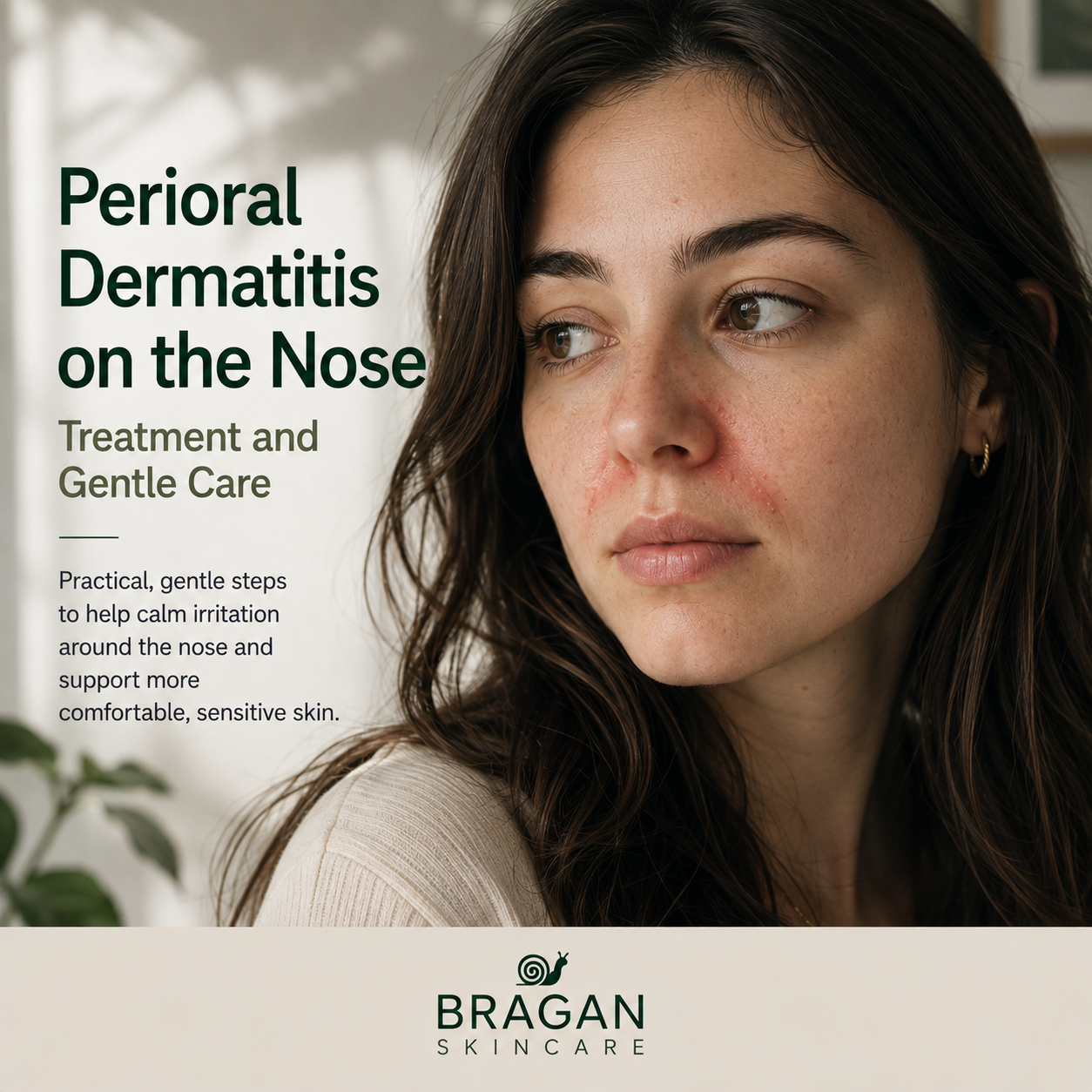 Woman with visible redness and small bumps around the sides of her nose, illustrating perioral dermatitis and gentle care for irritated skin.