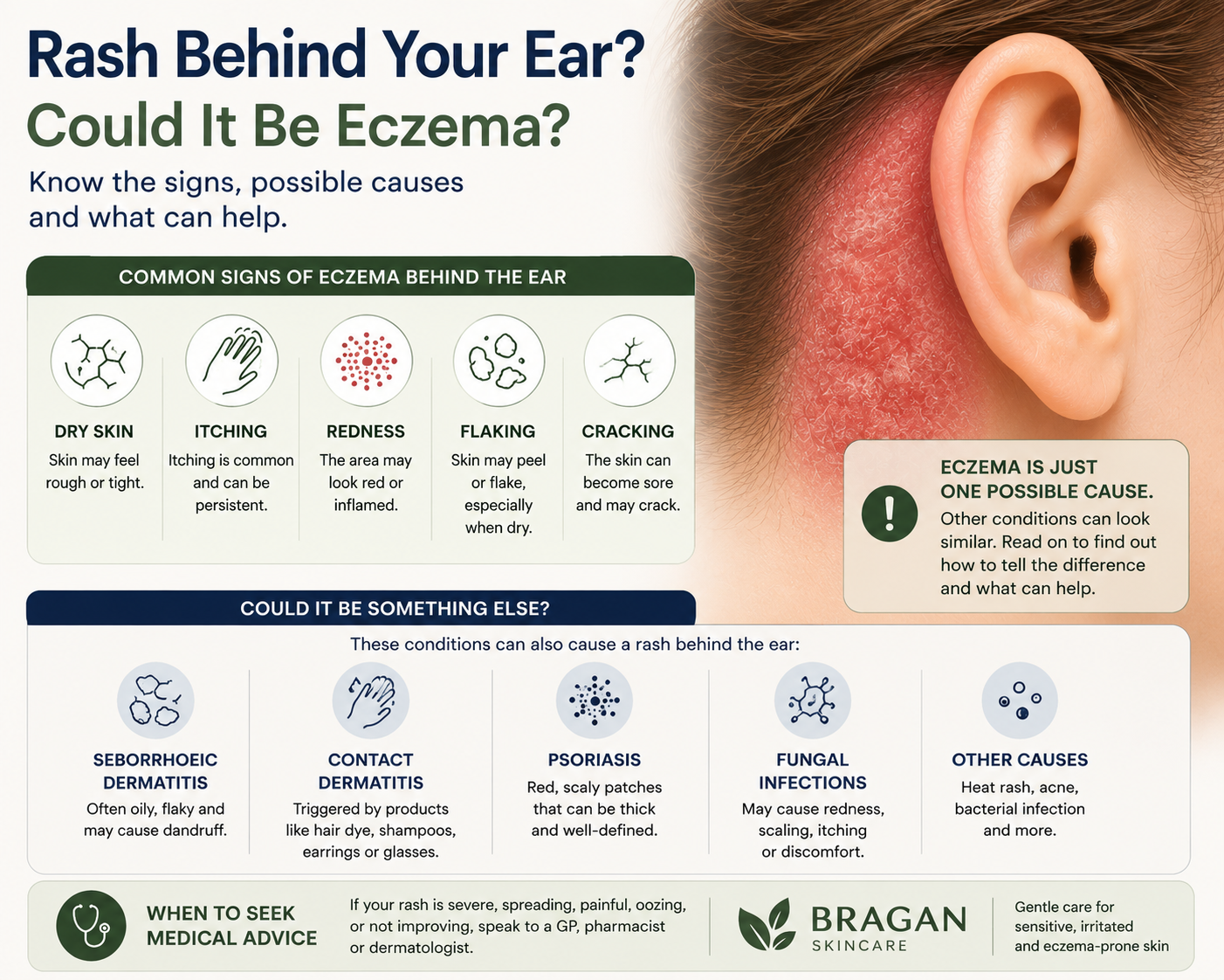 Infographic showing the common signs of eczema behind the ear, including dry skin, itching, redness, flaking and cracking, along with other conditions that may cause a rash behind the ear.