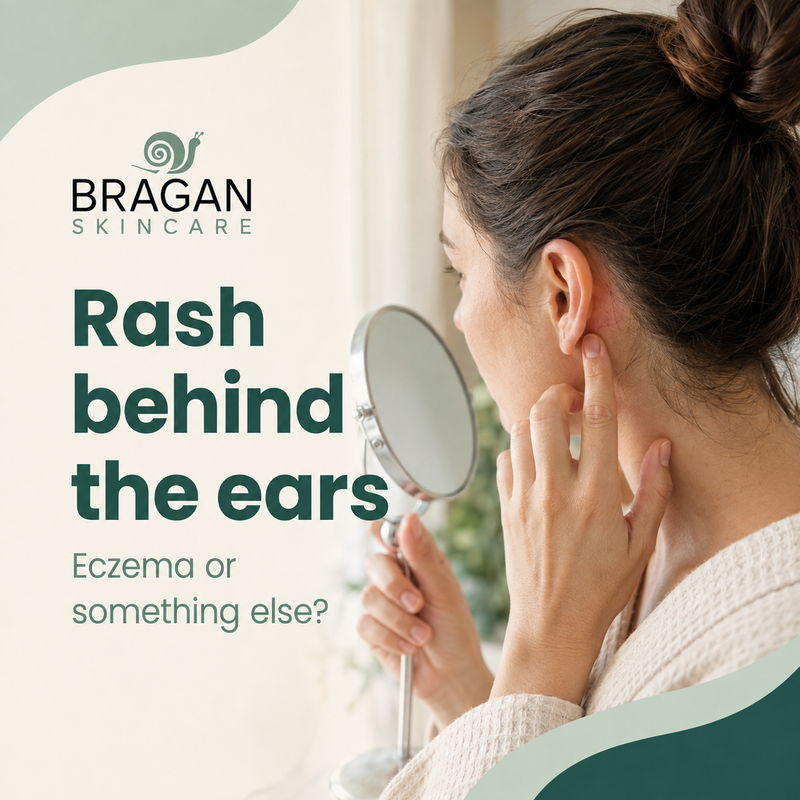 Rash behind the ears: eczema or something else?