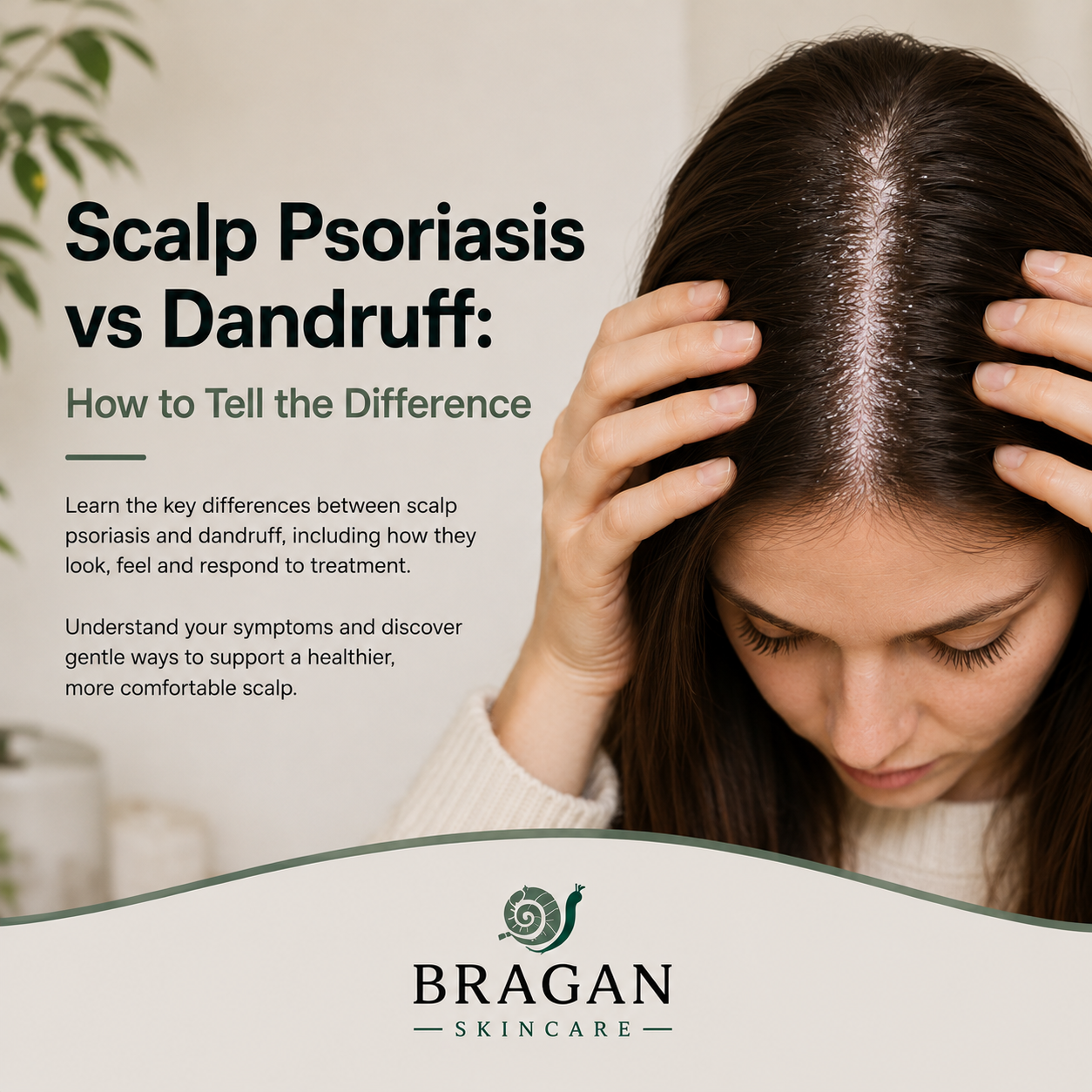 Woman parting her dark hair to compare scalp psoriasis and dandruff, illustrating the visible differences between thick psoriasis plaques and dandruff flakes while highlighting key signs, symptoms and gentle scalp care guidance.