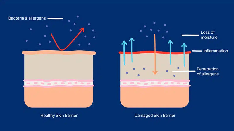 Rash on Private Areas: Causes, Symptoms, and Gentle Care