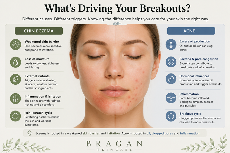 Chin Eczema vs Acne: What Is The Difference?