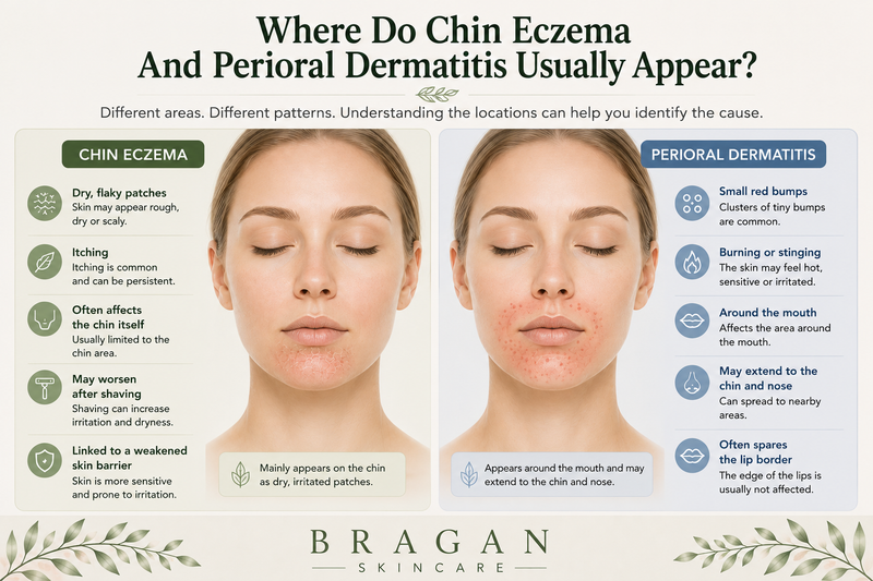 Chin Eczema vs Perioral Dermatitis: What Is The Difference?