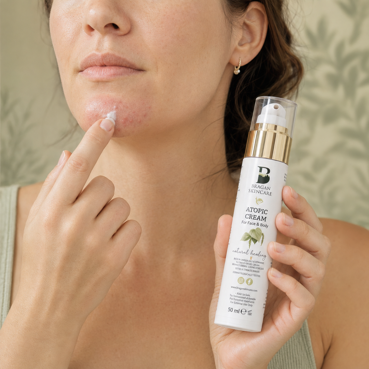 Applying Bragan Skincare Snail Mucin Atopic Cream as part of a skincare routine for acne-prone skin.