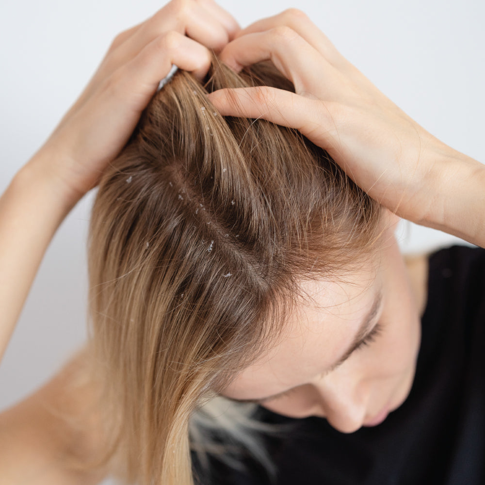 Seborrheic Dermatitis Treatment: How to Soothe & Control Flare-Ups