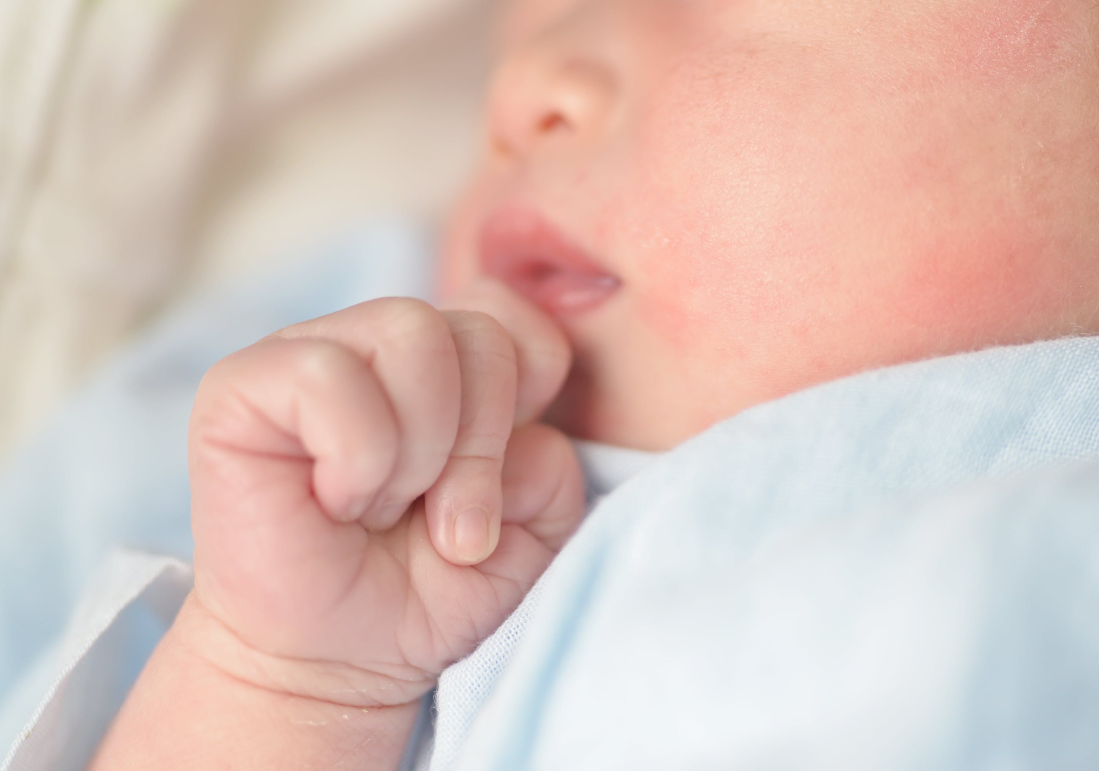 baby with facial eczema