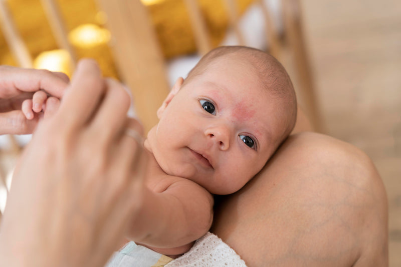 The Signs of Eczema in Infants: A Guide for Parents