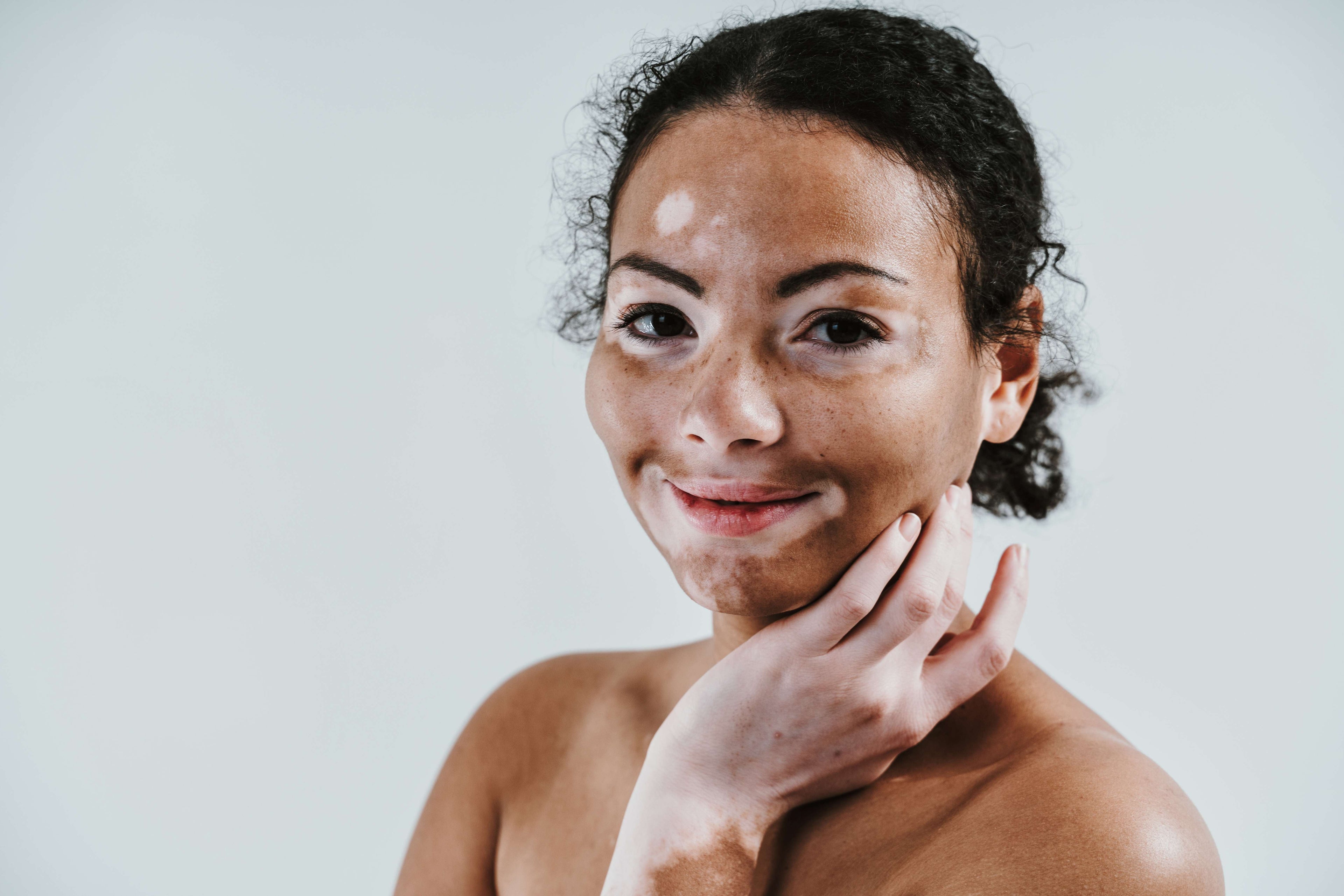 lady with sensitive skin