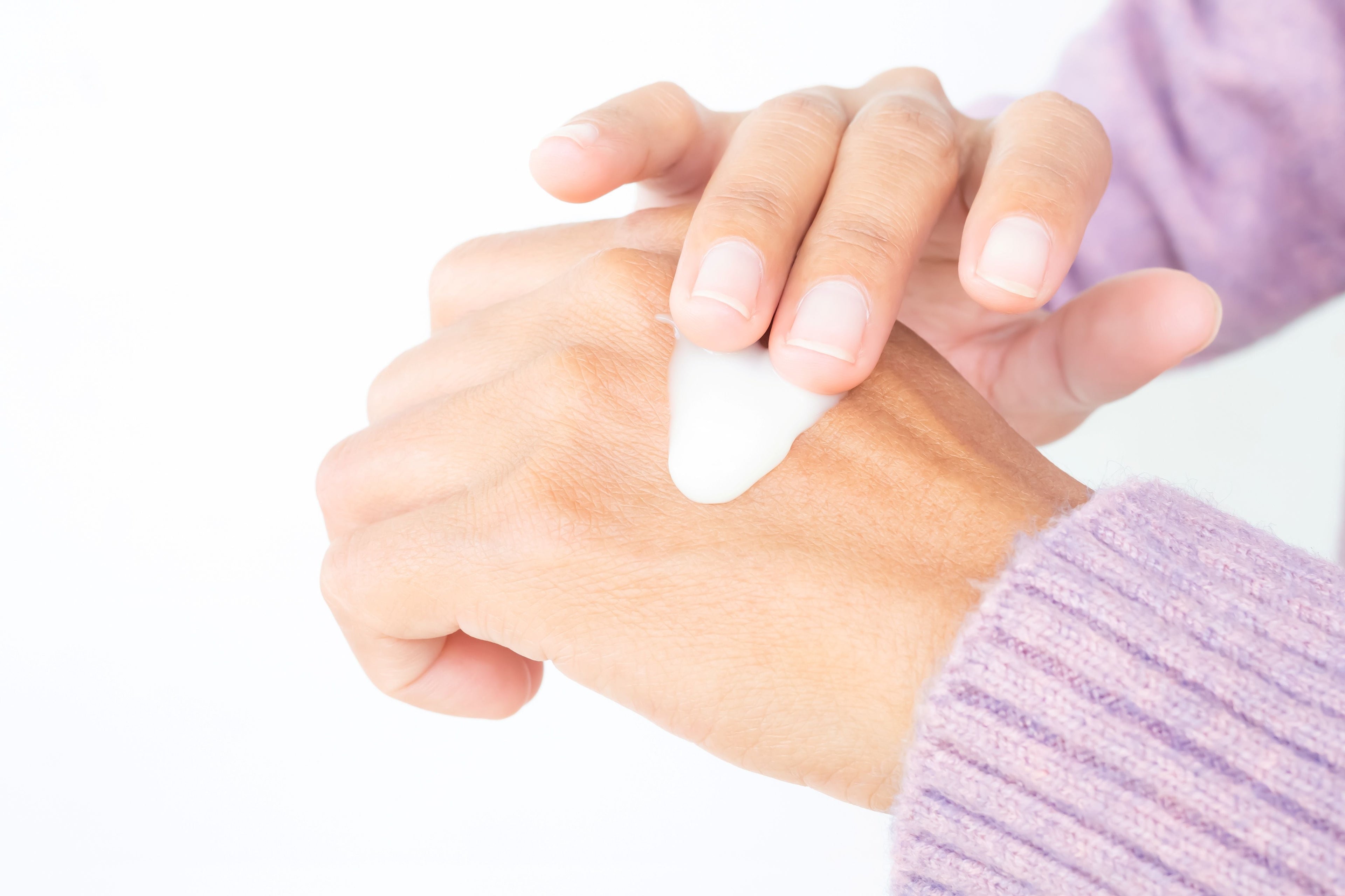 no sting eczema cream being applied