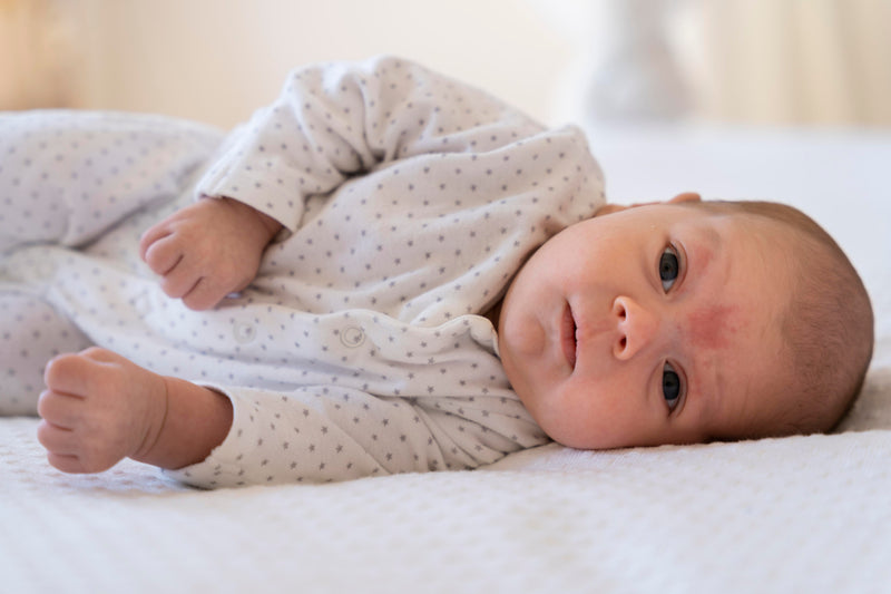 Signs of Eczema in Babies: How to Spot Symptoms and Soothe Sensitive Skin