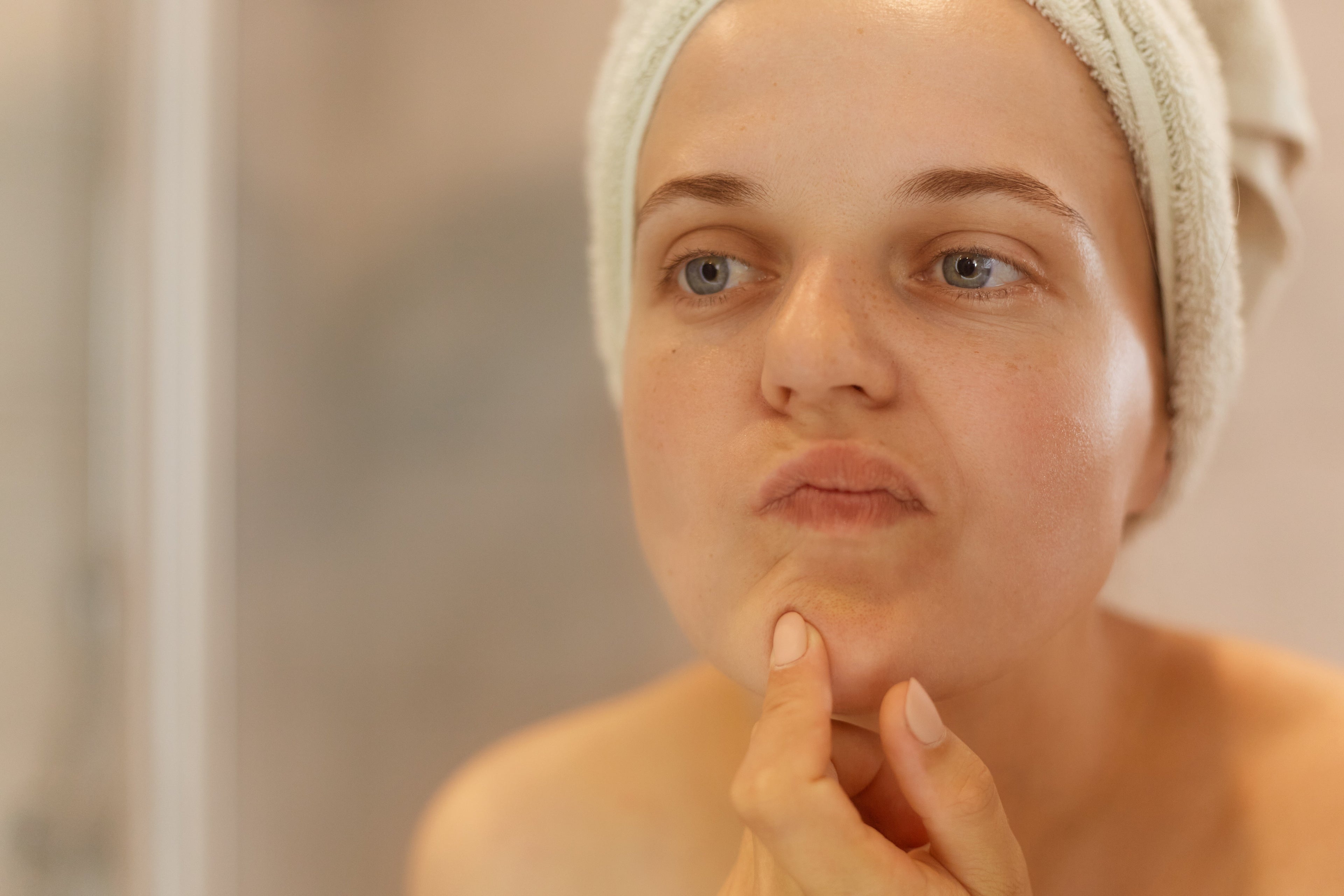 lady examining facial eczema in the mirror