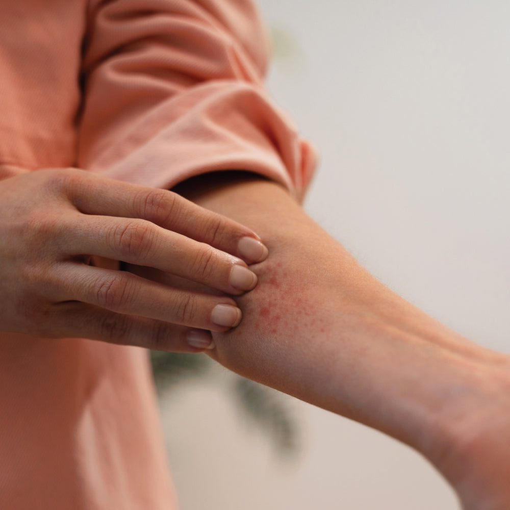 eczema itch on the arm