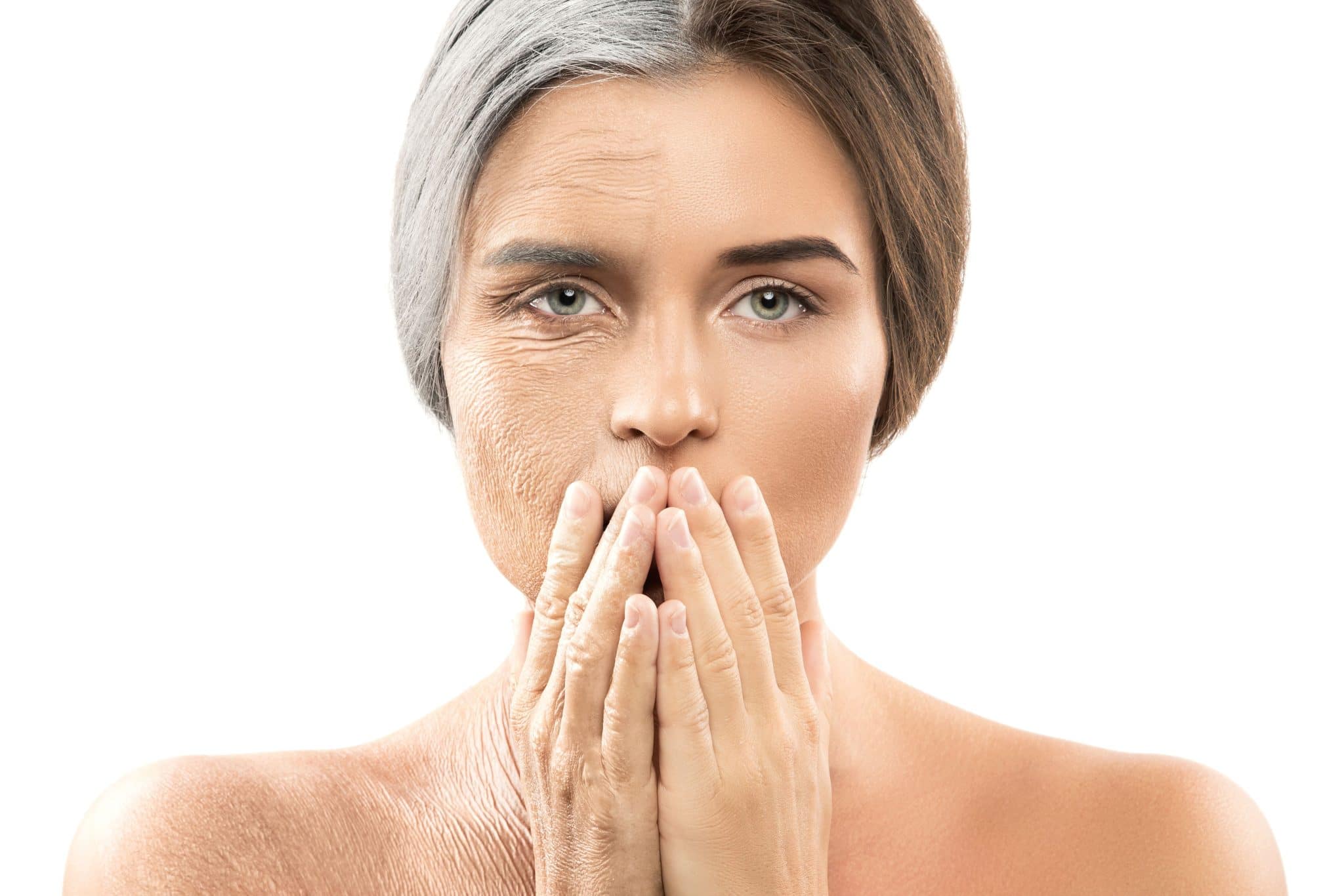 Dry, flaky skin on a woman's face