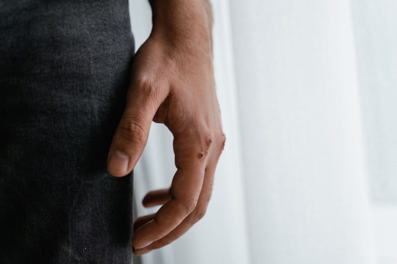 Dyshidrotic Eczema or Something Else? How to Tell the Difference