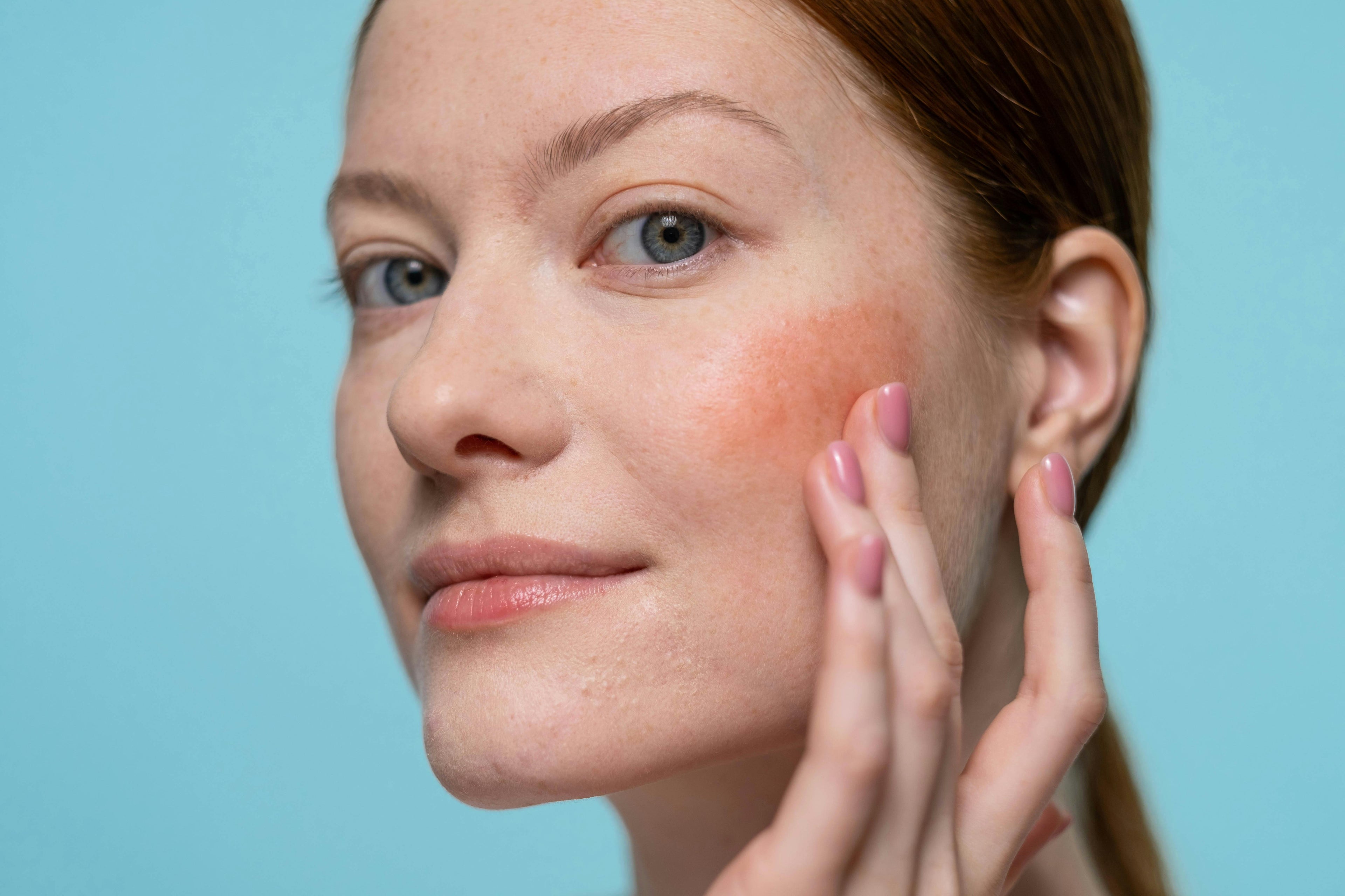 sensitive skin on the face