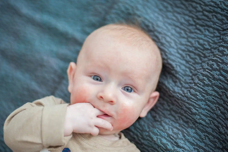 Baby Eczema and Eczema Prone Skin