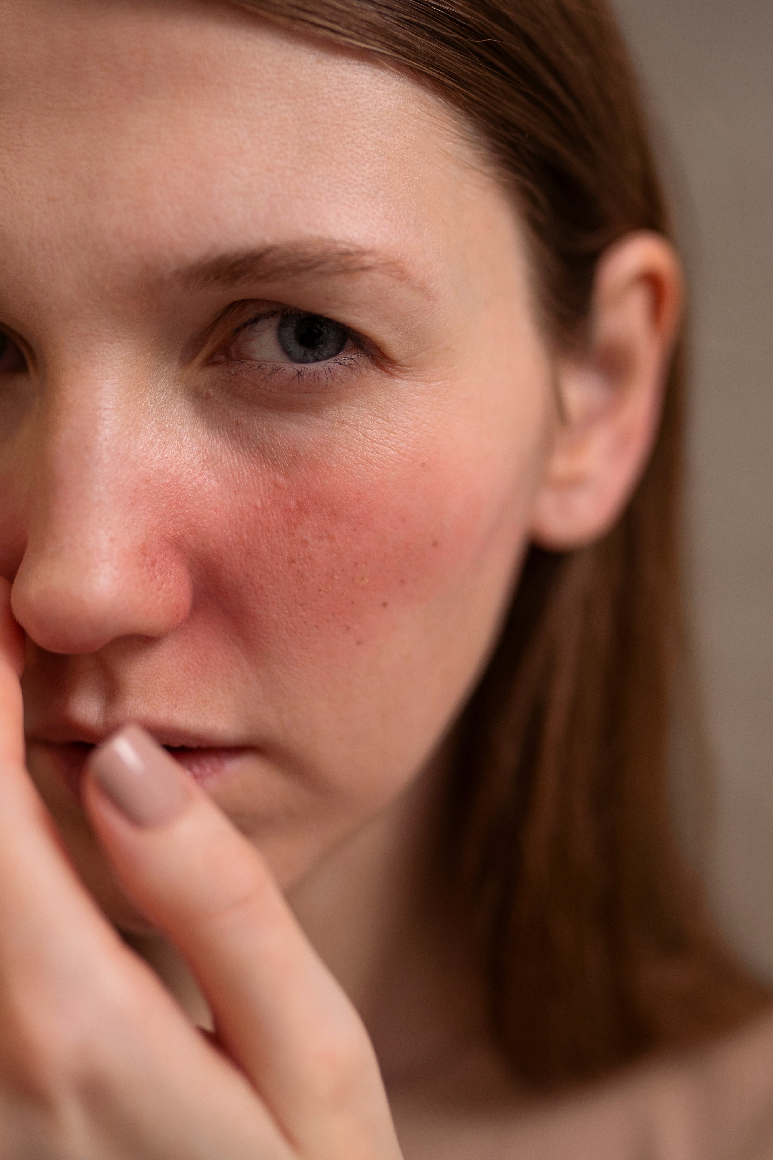 Eczema Flare-Ups: What Causes Them and How to Stop Them
