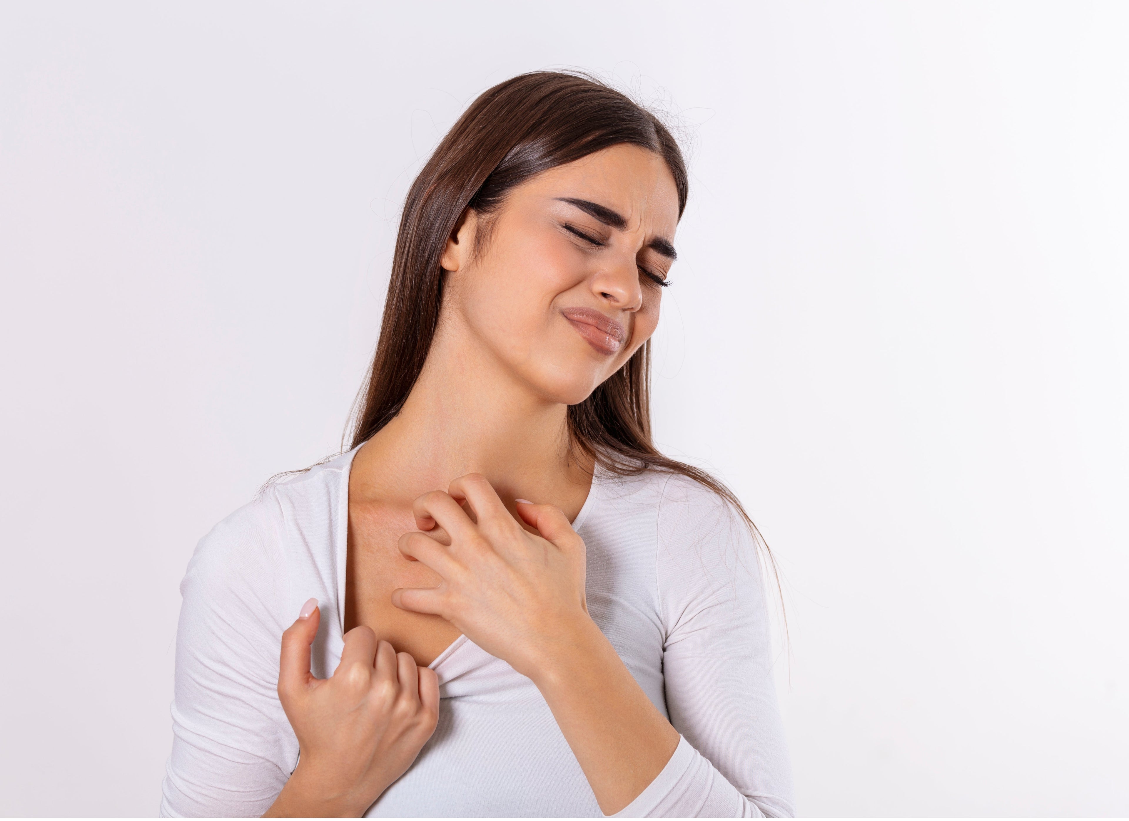 lady suffering with eczema flare-up