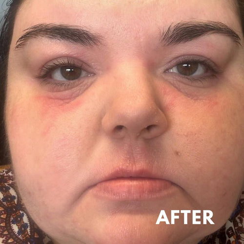 Atopic Cream for Sensitive & Irritated Skin