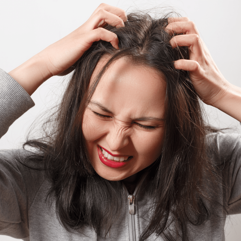 Seborrheic Dermatitis Treatment, treat seborrheic dermatitis, ​sebhorrheic dermatitis, dandruff treatment, scalp inflammation, skin flakes, oily scalp care, ​seborrheic dermatitis, dandruff, scalp rash, skin inflammation, oily skin, flaky scalp
