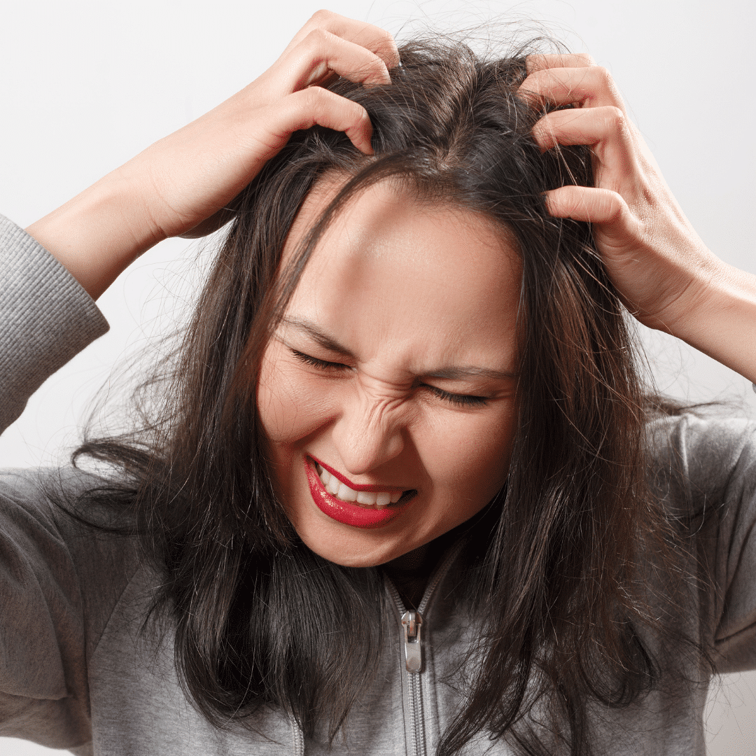 shampoo for itchy scalp, best shampoo for itchy scalp, itchy scalp relief shampoo, gentle shampoo for itchy scalp, dandruff shampoo for itchy scalp, Seborrheic Dermatitis Treatment, treat seborrheic dermatitis,