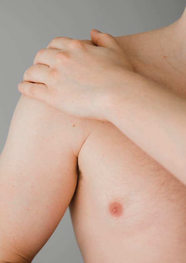 psoriasis cream, treat eczema, eczema on elbows,
