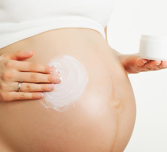 Stretch marks