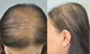 hair growth shampoo,
