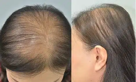 hair growth shampoo,