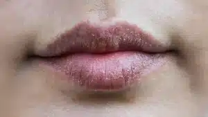 dry chapped lips, lip care, beat lip baln, chapped lips, dry lips,