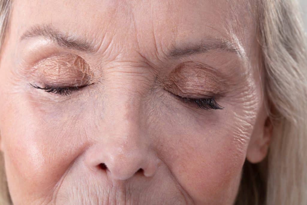 dry flaky skin face,