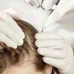 Natural Shampoos for Sensitive Scalps, Best Shampoo for Sensitive Scalps, seboorheic dermatitis shampoo